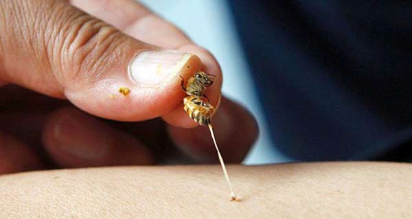 Bị ong đốt bôi thuốc gì? Cách xử trí khi bị ong đốt